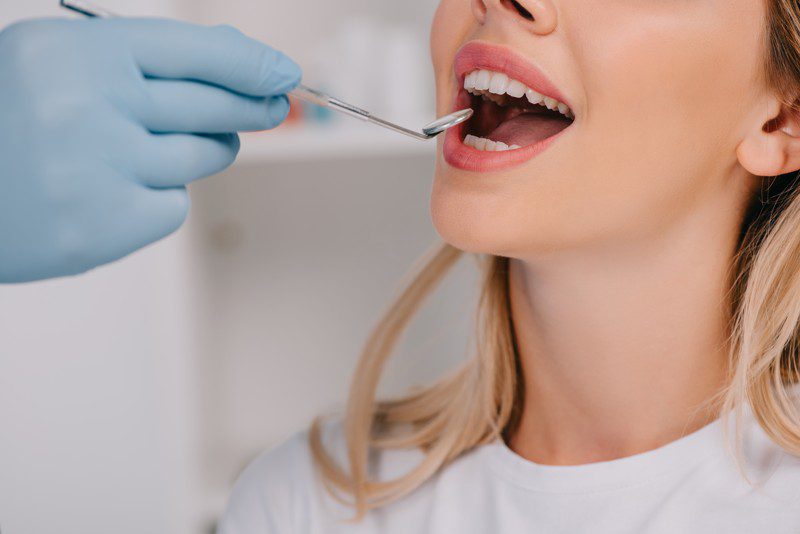 ¿Cómo trabajar de higienista dental en Estados Unidos?