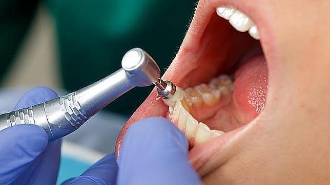 ¿Cómo es la carrera de higienista dental en Estados Unidos?