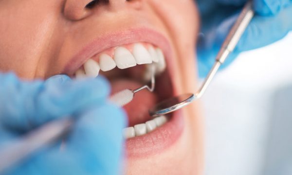 ¿Cómo trabajar como higienista dental en Estados Unidos?
